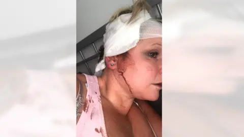 Kelda Griffiths PC Kelda Griffiths bloodied