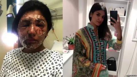 Resham Khan Before and after the attack