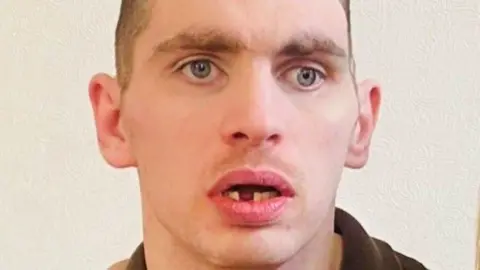 Jordan Jones looking at the camera, his mouth is open and a lower tooth is missing.