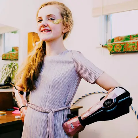 Open Bionics Tilley Lockey