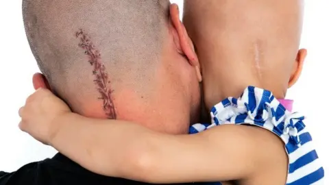 Cancer Research UK/PA Wire Aaron Lambert and daughter Esme