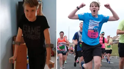 Supplied Ethan as a 14 year old on crutches and Ethan running the Great North Run - he is celebrating with his arms in the air