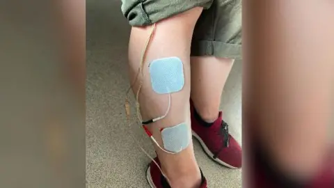 Jules Hobbs A set of electrodes attached to Jules' right calf . She is wearing khaki trousers and red trainers.