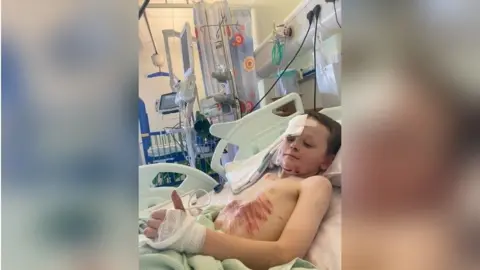 Supplied Dan lying in his hospital bed. He has a bandage taped to his forehead and cuts to his chin and large scrapes across his chest. He is giving a thumbs-up gesture.