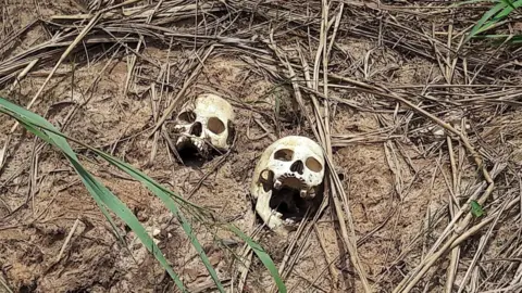 Reuters Skulls of victims of fighting in Kasai