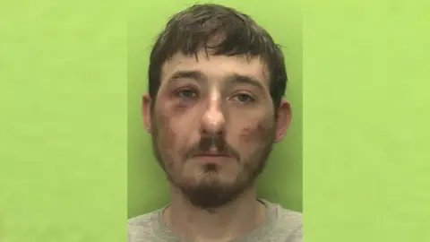 Headshot of Dean Kirby against a green background. He has a moustache and multiple scratches and bruises on his face