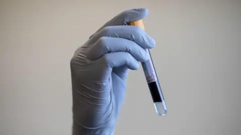 A stock image of a gloved hand holding a vial of blood