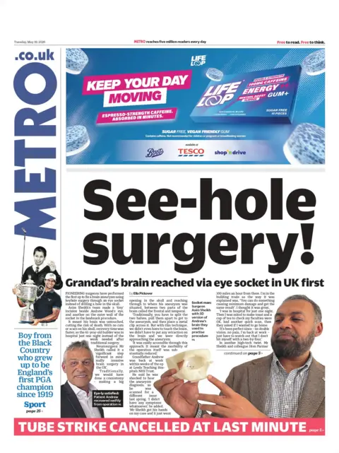 "See-hole surgery!" is the Metro's headline on the front page.