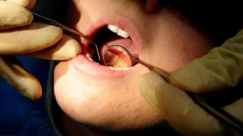 A dental procedure