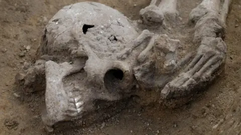 Dave Webb, Cambridge Archaeological Unit Skull at skeleton fee, Knobb's Farm, Somersham