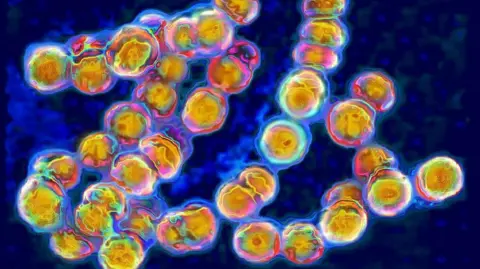Getty Images Optical microscopy of Streptococci, a bacteria with a rounded shape involved in meningitis.