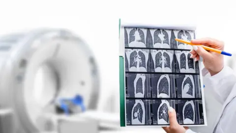 Getty Images Scans of lung in black and white with a white CT scanner machine out of focus in the background with the arm of a medic in a white coat pointing at the scans with a ballpoint pen