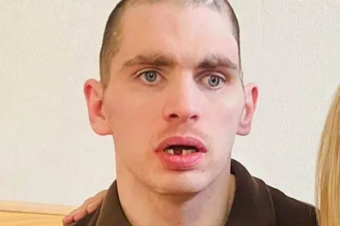 Caroline Munro Jordan Jones looking at the camera, his mouth is open and a lower tooth is missing.