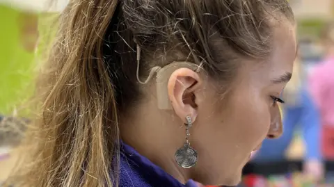 A close-up of a woman's ear with a cochlear implant.  She is wearing earrings, her hair in a pony tail and a purple top.  