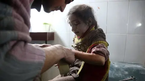 AFP A wounded girl receives treatment following a reported government air strikes on the town of Hamouriya, in the besieged rebel-held Eastern Ghouta (8 February 2018)