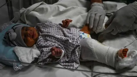 AFP Baby Amina in hospital