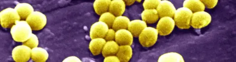 BSIP Staphylococcus Aureus