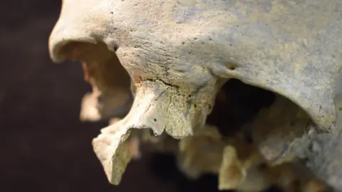 After the Plague 'Dickon' - skull