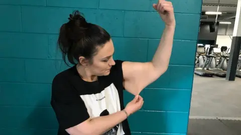 Steph pulling on her arm skin