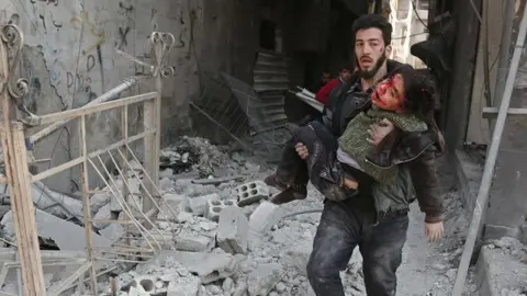 Getty Images Siege of Eastern Ghouta