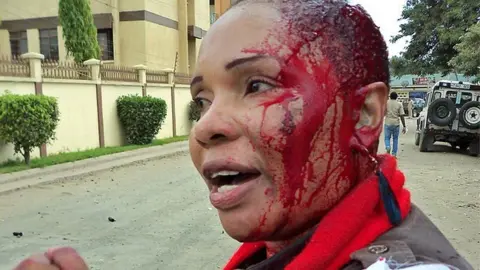 Getty Images This photo made on January 5, 2011 shows Josephine Slaa, wife of an anti-graft campaigner, Wilbrod Slaa, a presidential contender who emerged second after Tanzania's re-elected President, Jakaya Kikwete, bleeding from a gash on her head after she was attacked by anti-riot police during a peaceful demonstration by supporters of the main opposition party CHADEMA