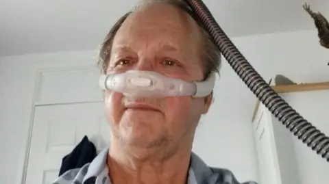 Trevor Entwistle pictured wearing a nasal mask connected to a machine. He has a balding head with grey hair down the side and is stood in a room looking at the camera