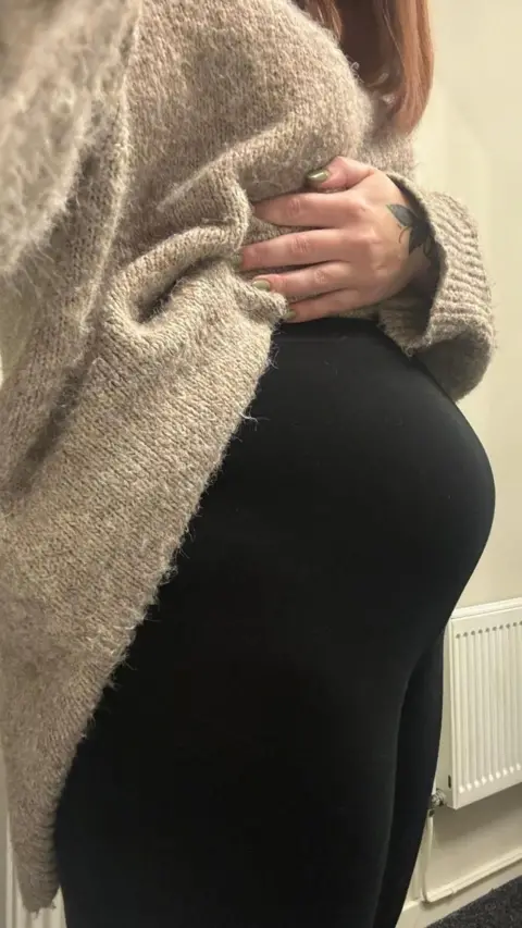 Amy-Jane Davies The image shows Amy holding her jumper above her tummy, to reveal a distended abdomen, caused my what she described as "endo-belly", referring to the symptoms caused by endometriosis.