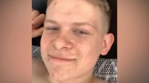 Lisa Collins A teenage boy with blonde hair pictured close up to his face.