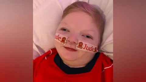 Walsall Healthcare NHS Trust Close-up of a child lying in a hospital bed, wearing a red football-style shirt. The child has short, light-coloured hair and is resting on a white pillow. A nasal feeding tube is secured across the cheeks with decorative tape featuring teddy bear illustrations and the visible text “Jude.” The image is tightly framed around the child's face and upper body, with soft indoor lighting and hospital bedding visible in the background. The child is looking towards the camera, and the red shirt contrasts with the white bedding and pale background.
