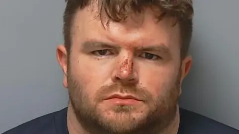 A mugshot of Watts. He has brown hair and a brown beard. He has blood on his nose.