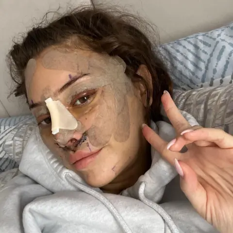 Emily Emily post surgery. She has plasters across her brow and cheeks as well as on her nose. She is holding up two fingers to the camera in a v sign as she lays on a bed