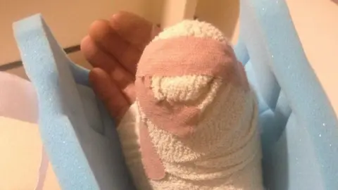 Supplied A heavily bandaged hand