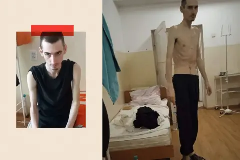 Two separate images of Leonid Popov - in one his shirt is removed and his ribs are visible