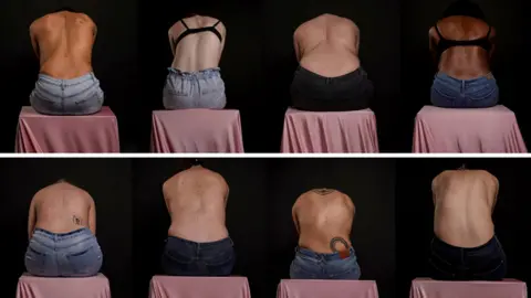 Ayesha Jones A composite photograph with two rows. In each row, there are four women sitting on pink stools. They have their backs to the camera and their heads bowed. They are wearing jeans and either no top or just a bra. Some have spines that curve noticeably sideways.