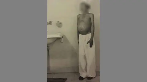 Knesset Special Committee A disturbing photograph shows a malnourished child in hospital with the location of the spleen marked on their body in pen