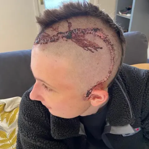 Cambs Police PC Leo Clarke with stitches in head