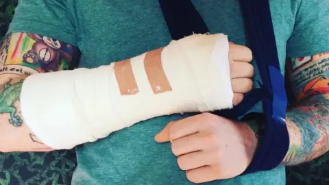 Ed Sheeran / Instagram Ed Sheeran's arm