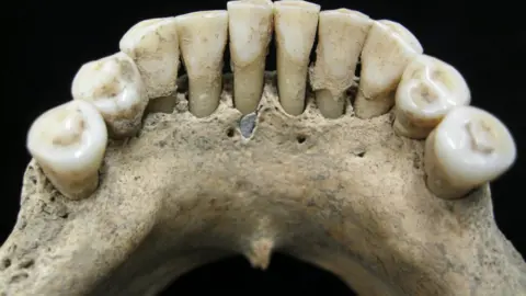 Christina Warinner teeth