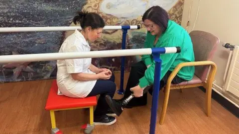 Woman patient and female physiotherapy assistant looking at and talking about prosthetic legs.