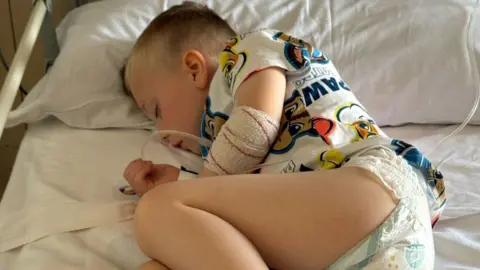 Young boy lies in a hospital bed wearing white shirt with cartoon faces and a nappy. A tube is coming out of his bandaged elbow.