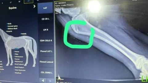 Lucy Loder X-ray showing fracture in leg bone