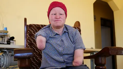 BBC Miriam Stafford está sentada em uma cadeira em frente a uma parede amarela. Ele usa um chapéu de malha vermelho e uma camisa de gola aberta. Suas mãos direita e esquerda deformadas são visíveis.