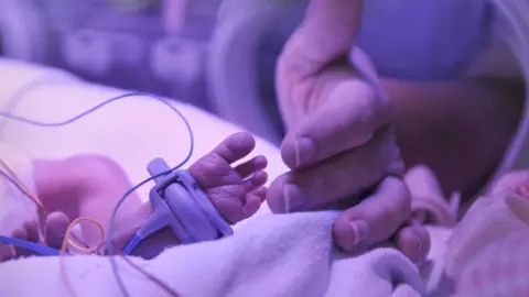 A baby in an incubator