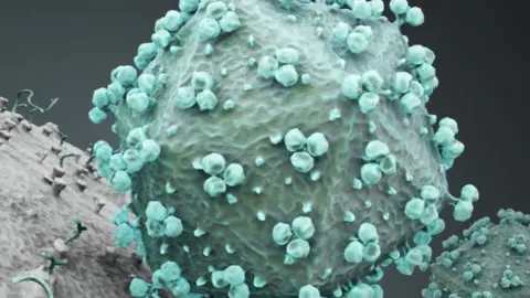 Thinkstock HIV particles