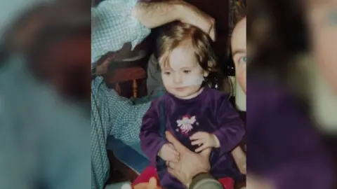 Millie Flemington-Clare An old photograph of Millie as a very young toddler, wearing a purple velvet dress, being held by an adult, just off camera. She has a tube comong out of her nose