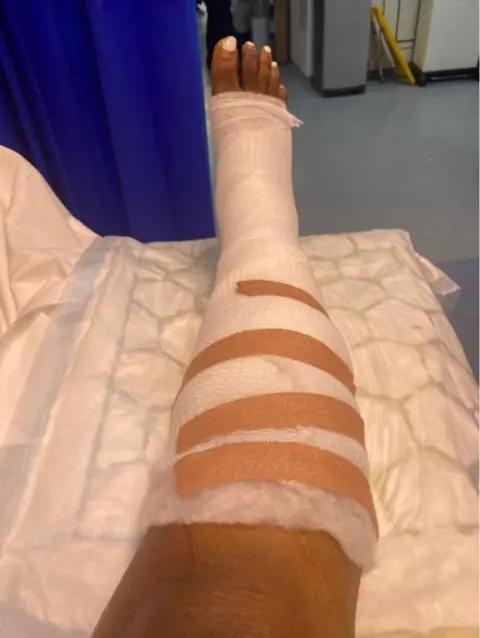 Louise Daramola Louise Daramola's leg bandaged up in a hospital setting