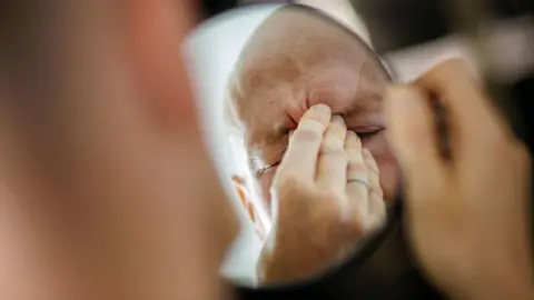 Getty Images A man rubs his aching head with his hand