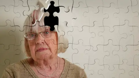 The photos of an elderly woman is made up of jigsaw pieces and one piece is missing in the head of an elderly woman. She has white hair and is looking to one side and is wearing a brown jumper.
