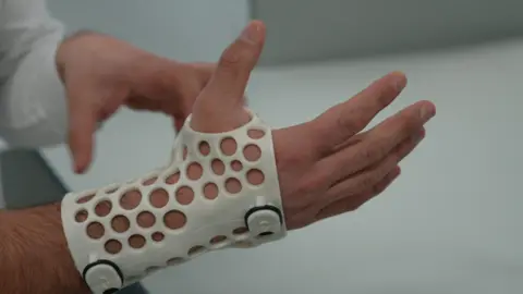 Picture shows a man's hand with a white plastic splint on with white holes. 