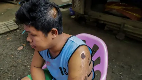 BBC Yan Naing Myo with injures